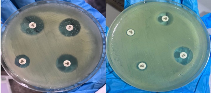 Antibiotics sensitivity discs