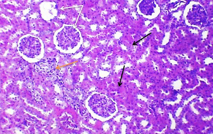 Histopathological Assessments on Kidney and Spleen of Experimentally Infected Male Rats by Staphylococcus aureus: Antibiotics versus Probiotics